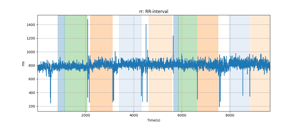 rr: RR-interval