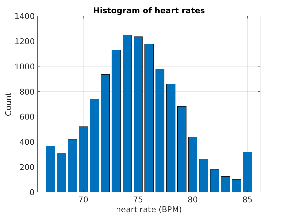 S020_ecg_hr_hist