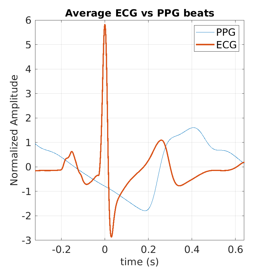 S020_ppg_avg_ecg_ppg