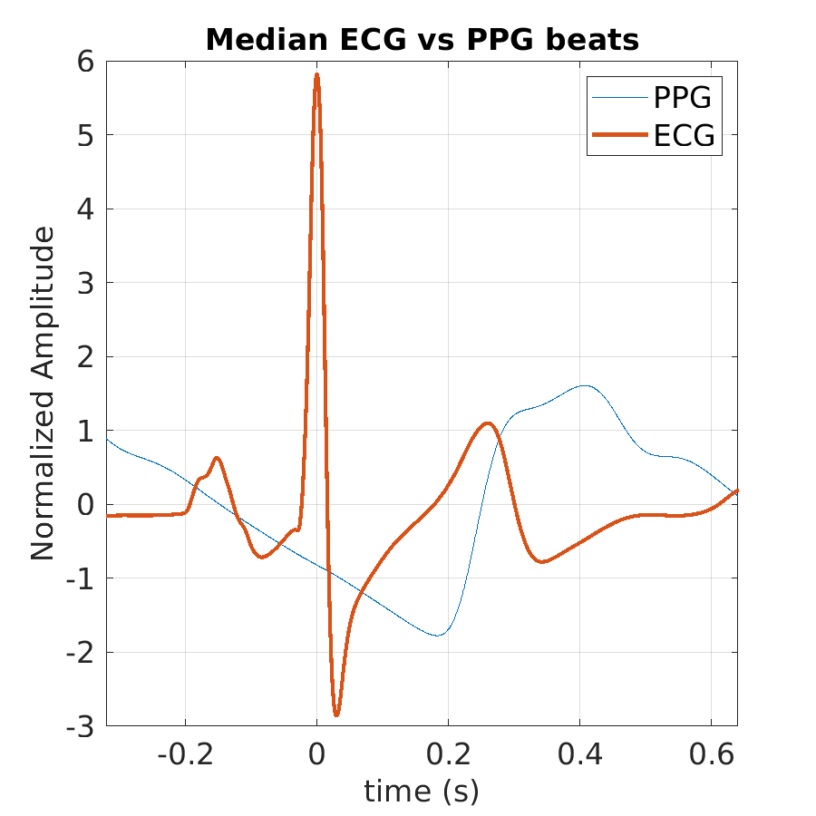 S020_ppg_med_ecg_ppg