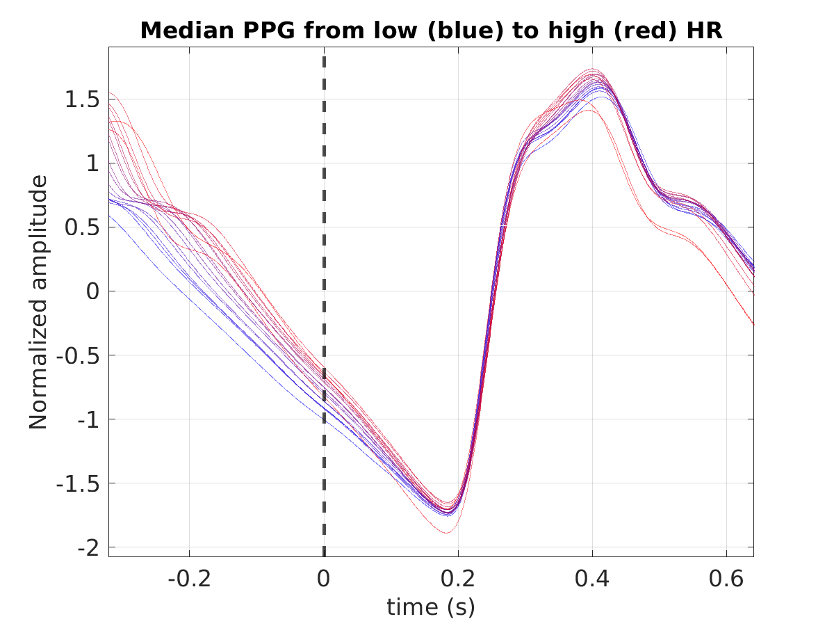 S020_ppg_med_ppg_hr_binned_norm