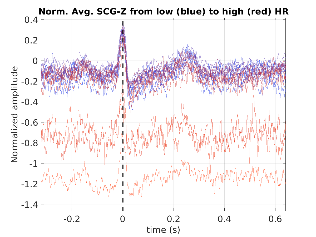 S020_scg_avg_scgz_hr_binned_norm