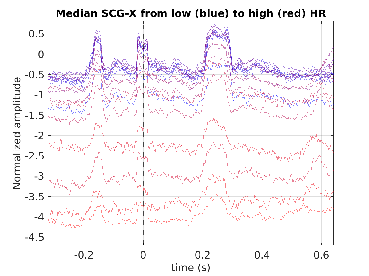 S020_scg_med_scgx_hr_binned_norm