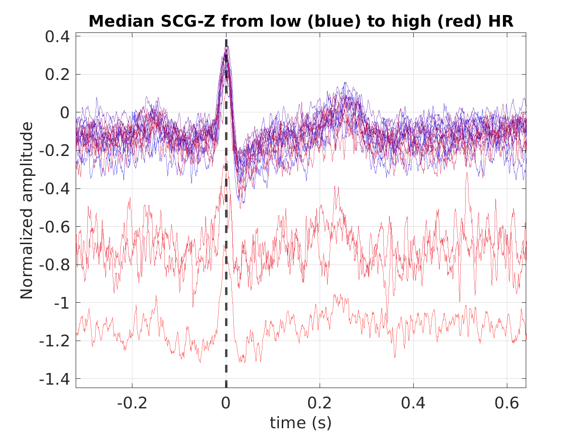 S020_scg_med_scgz_hr_binned_norm