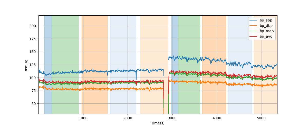 Subject S021 blood pressure data processing summary - Overlay