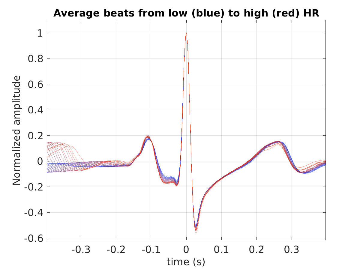 S021_ecg_avg_beats_hr_binned