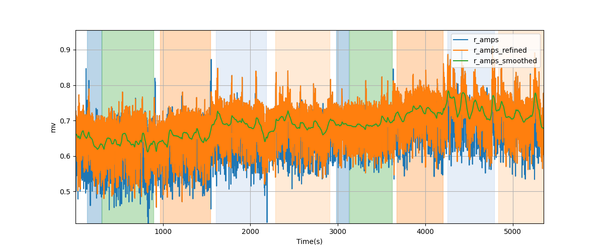 R-wave amplitudes - Overlay