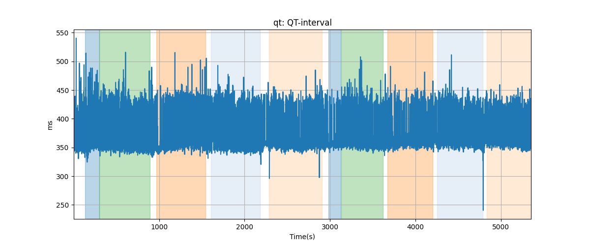 qt: QT-interval