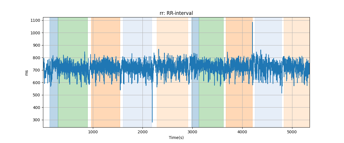 rr: RR-interval