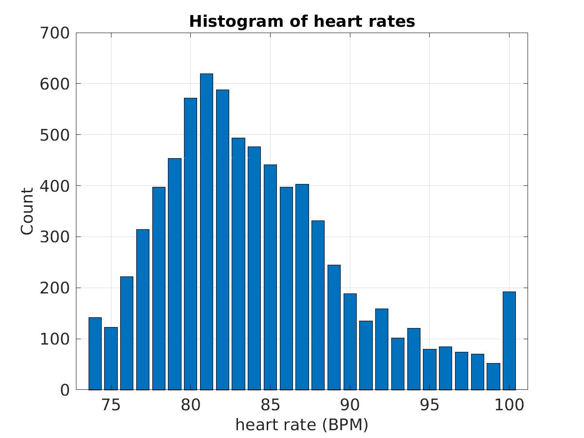 S021_ecg_hr_hist