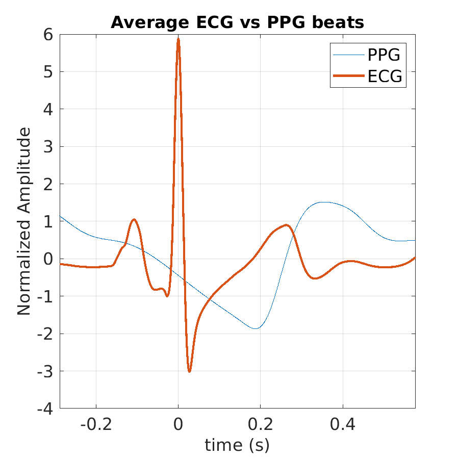 S021_ppg_avg_ecg_ppg