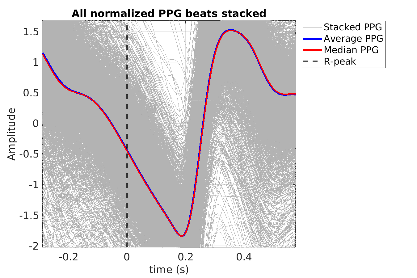 S021_ppg_ppg_stacked_norm