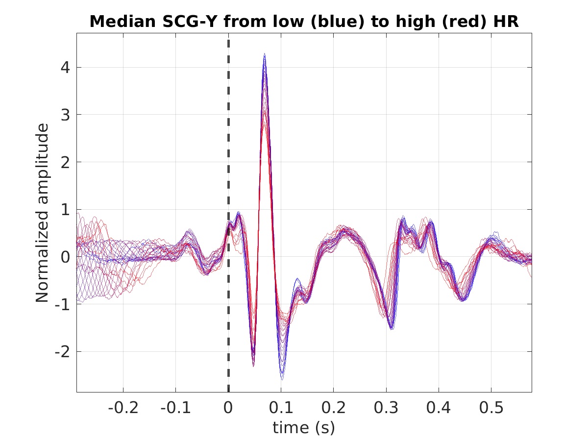 S021_scg_med_scgy_hr_binned_norm