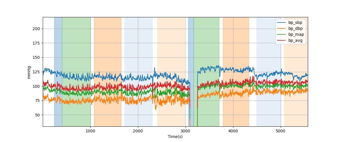 Subject S022 blood pressure data processing summary - Overlay