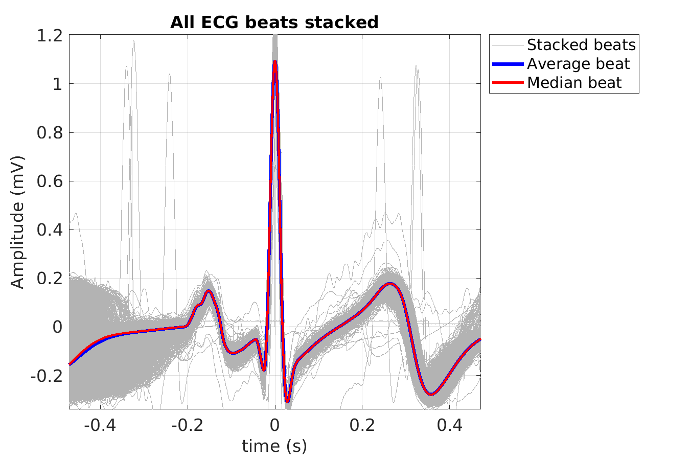 S022_ecg_beats_stacked