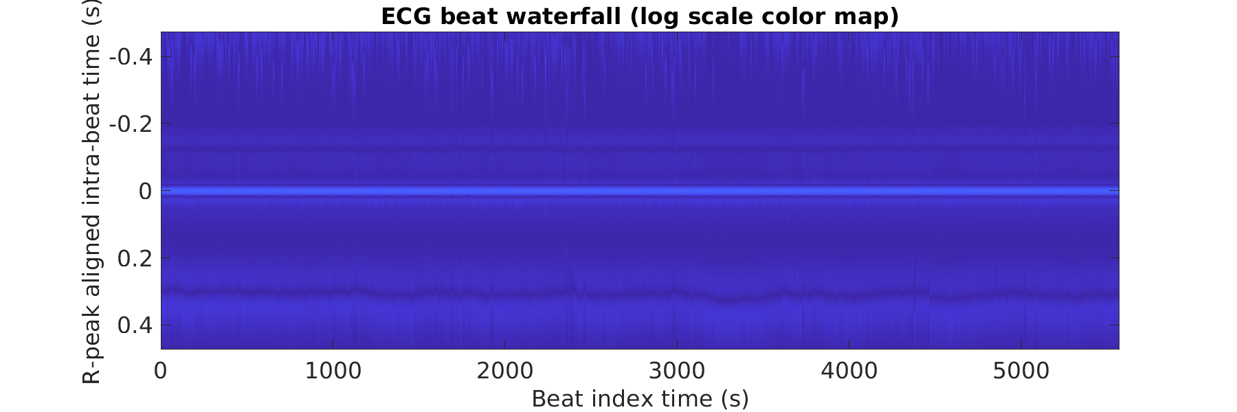 S022_ecg_beats_waterfall_logscale