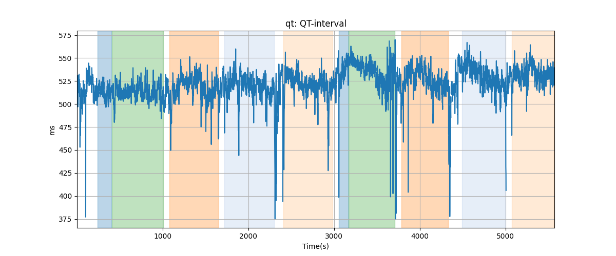 qt: QT-interval