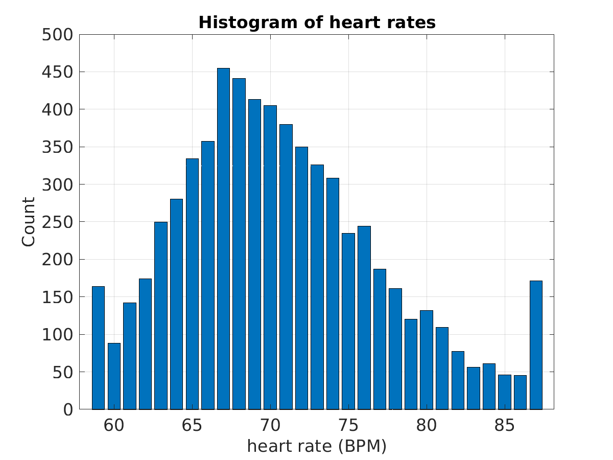 S022_ecg_hr_hist