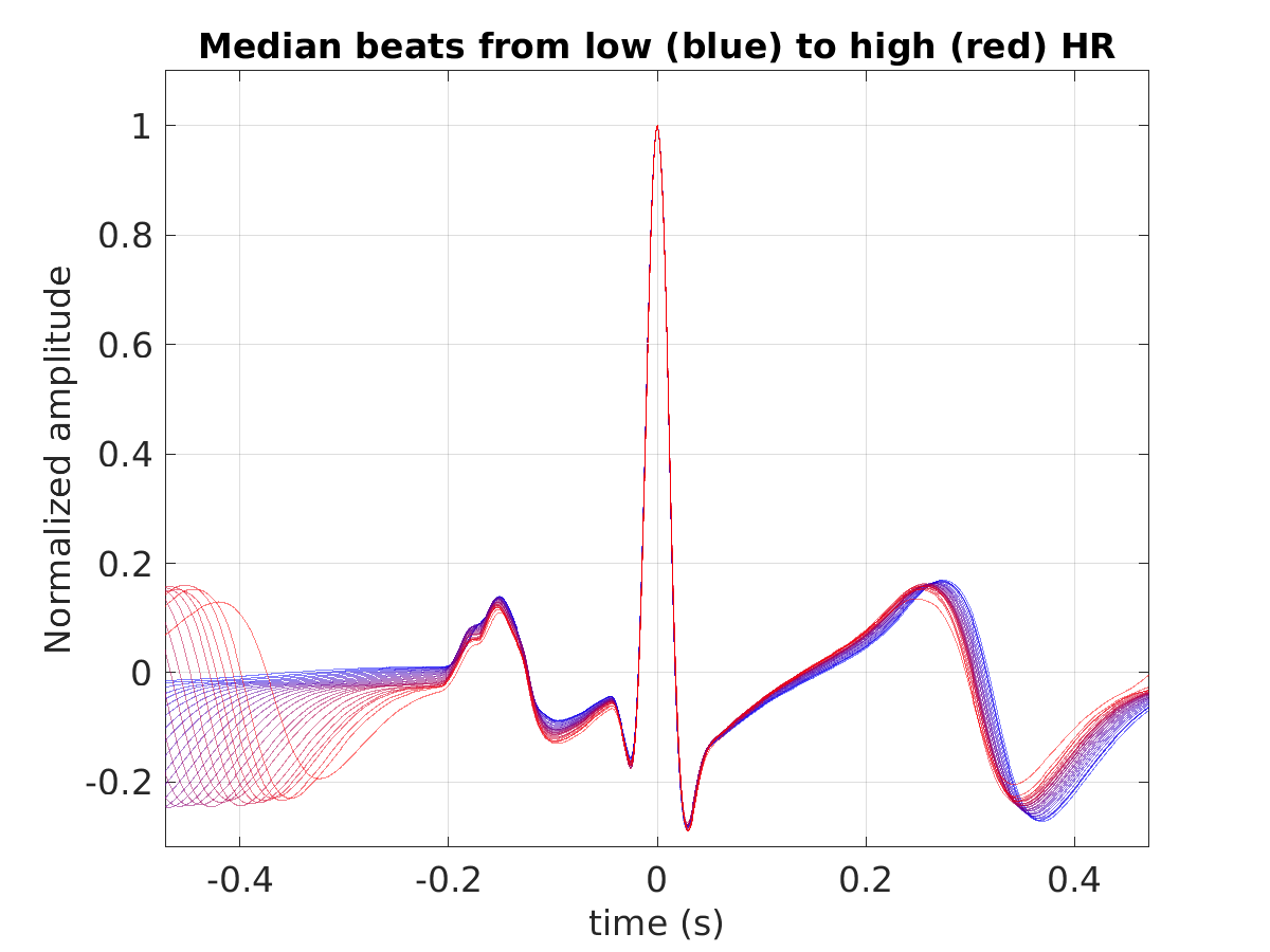 S022_ecg_med_beats_hr_binned