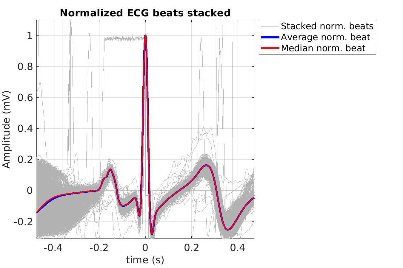 S022_ecg_norm_beats_stacked