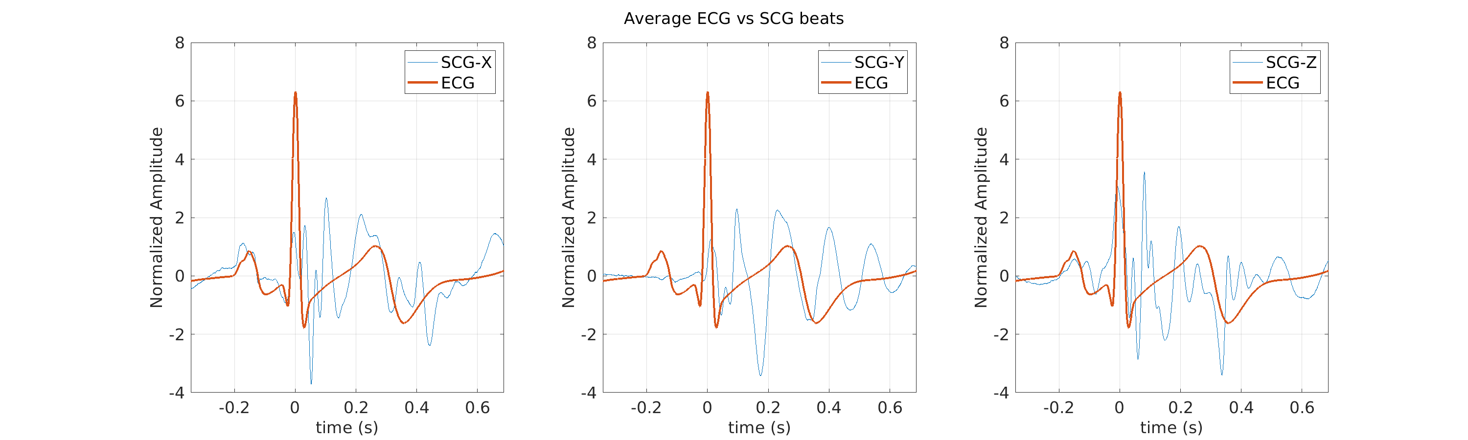 S022_scg_avg_ecg_scg