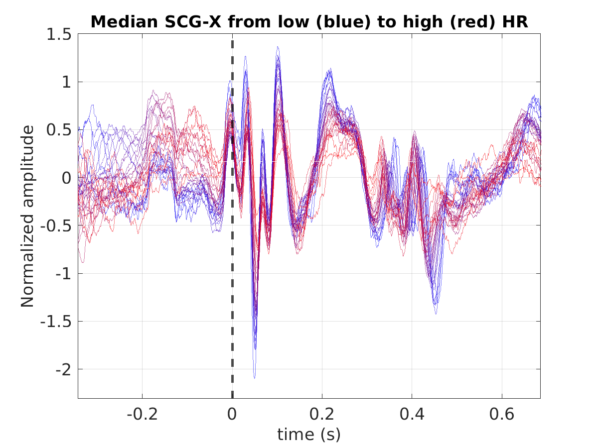 S022_scg_med_scgx_hr_binned_norm