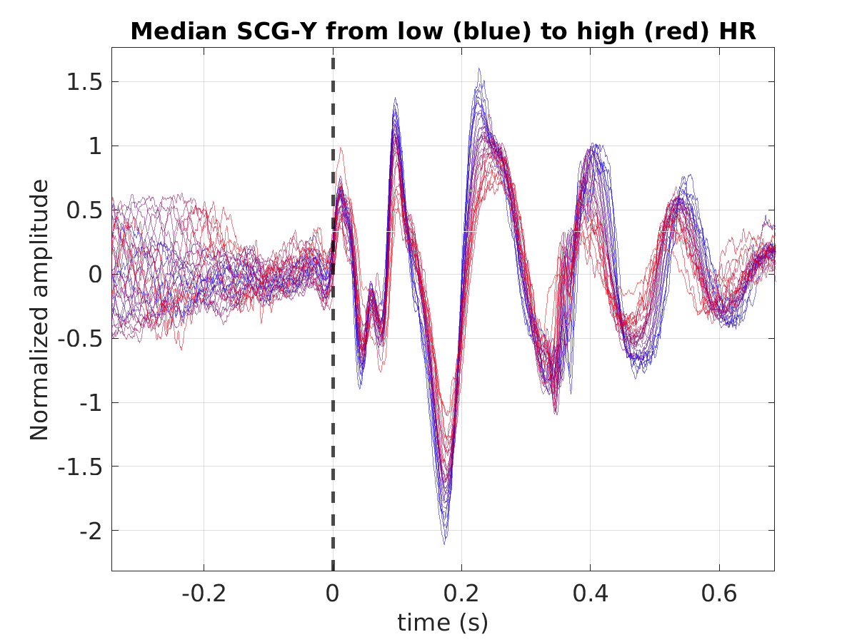 S022_scg_med_scgy_hr_binned_norm