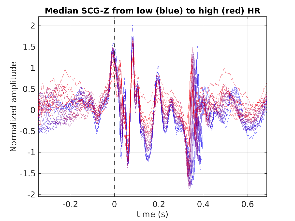 S022_scg_med_scgz_hr_binned_norm