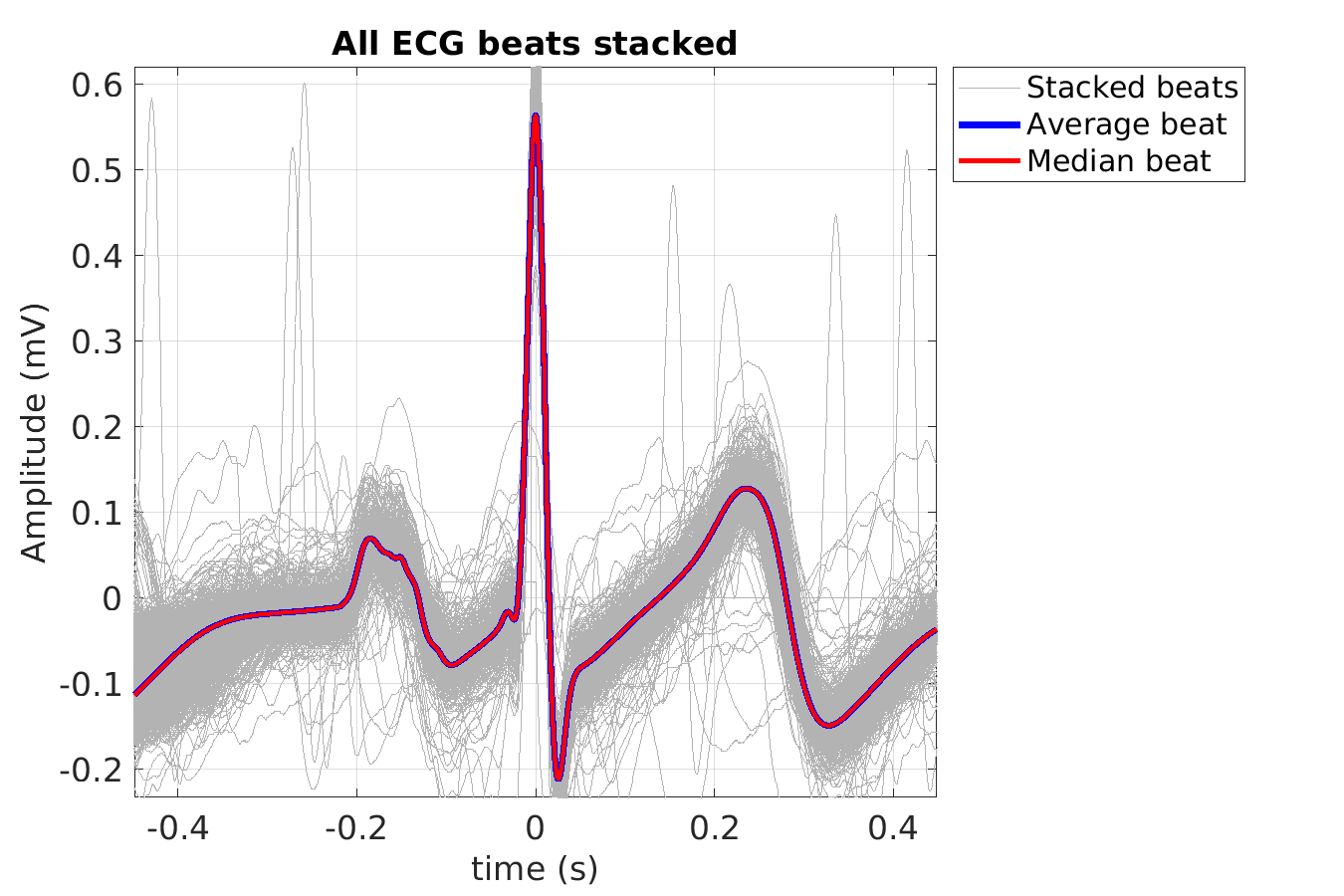 S024_ecg_beats_stacked