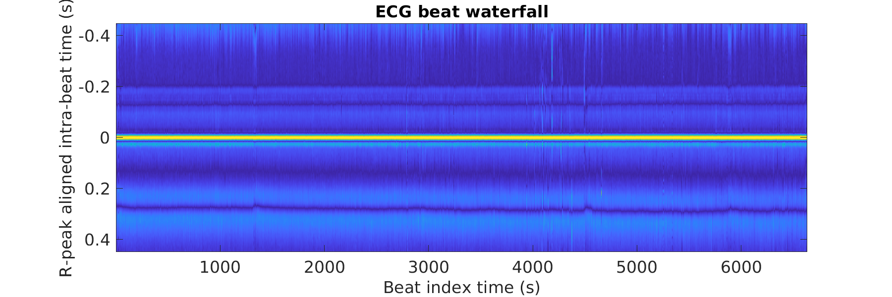 S024_ecg_beats_waterfall