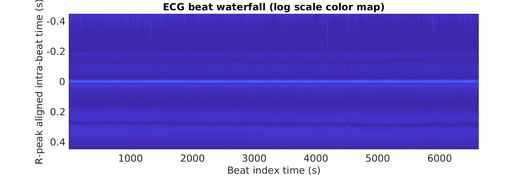 S024_ecg_beats_waterfall_logscale