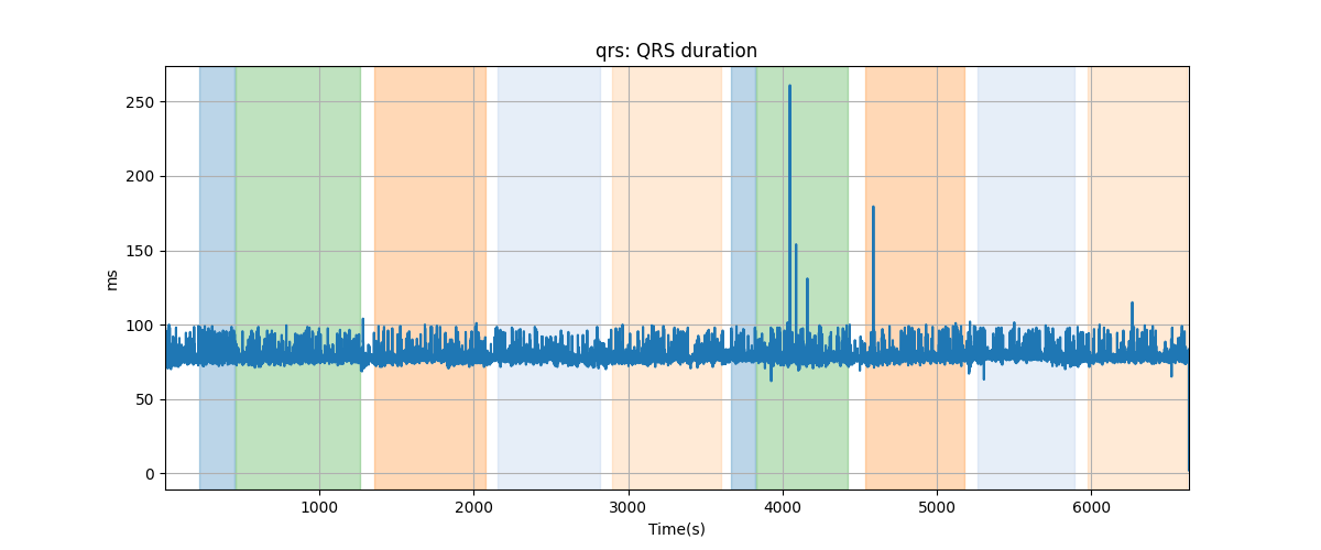 qrs: QRS duration