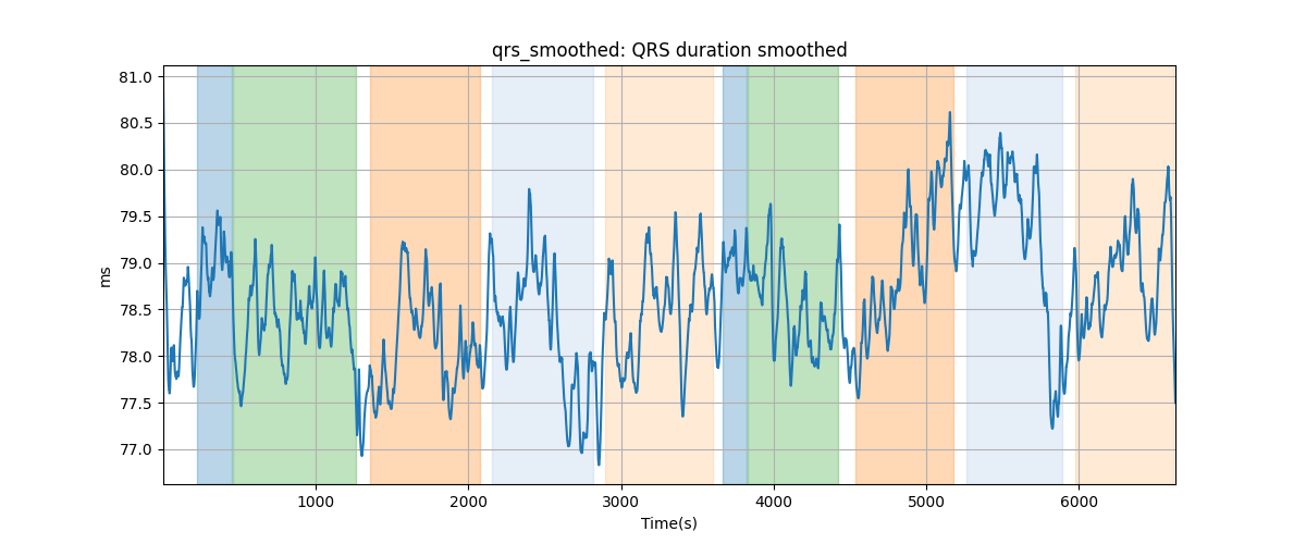 qrs_smoothed: QRS duration smoothed