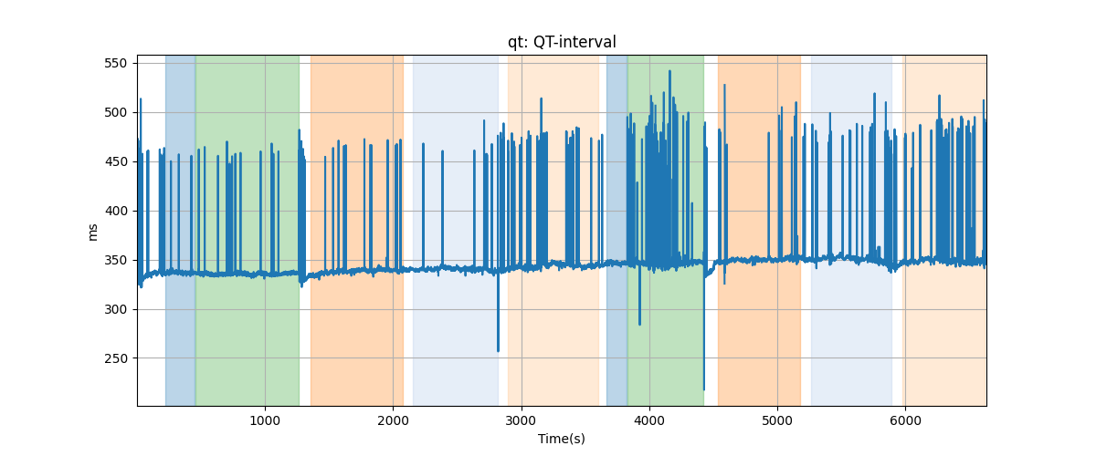 qt: QT-interval