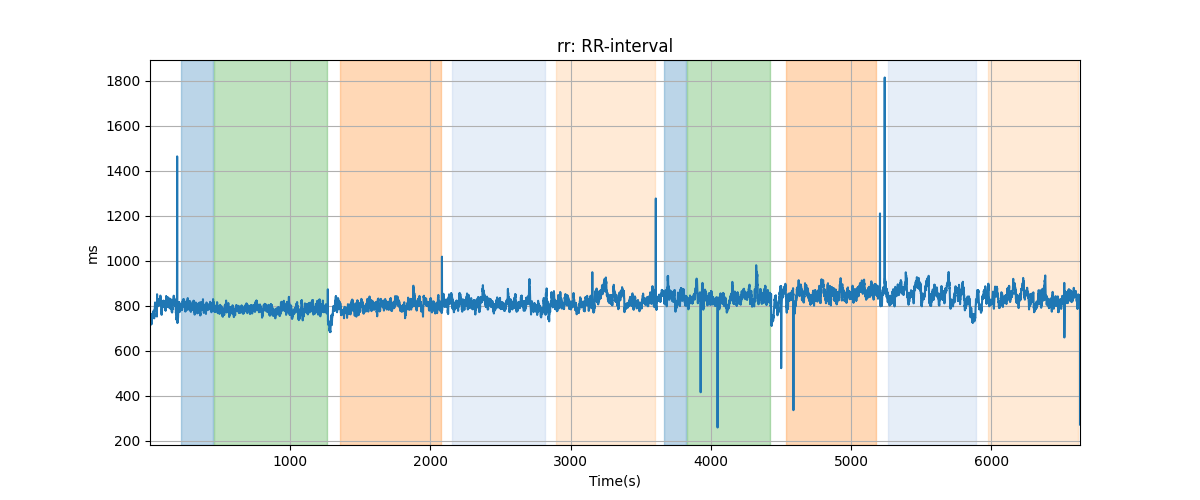 rr: RR-interval