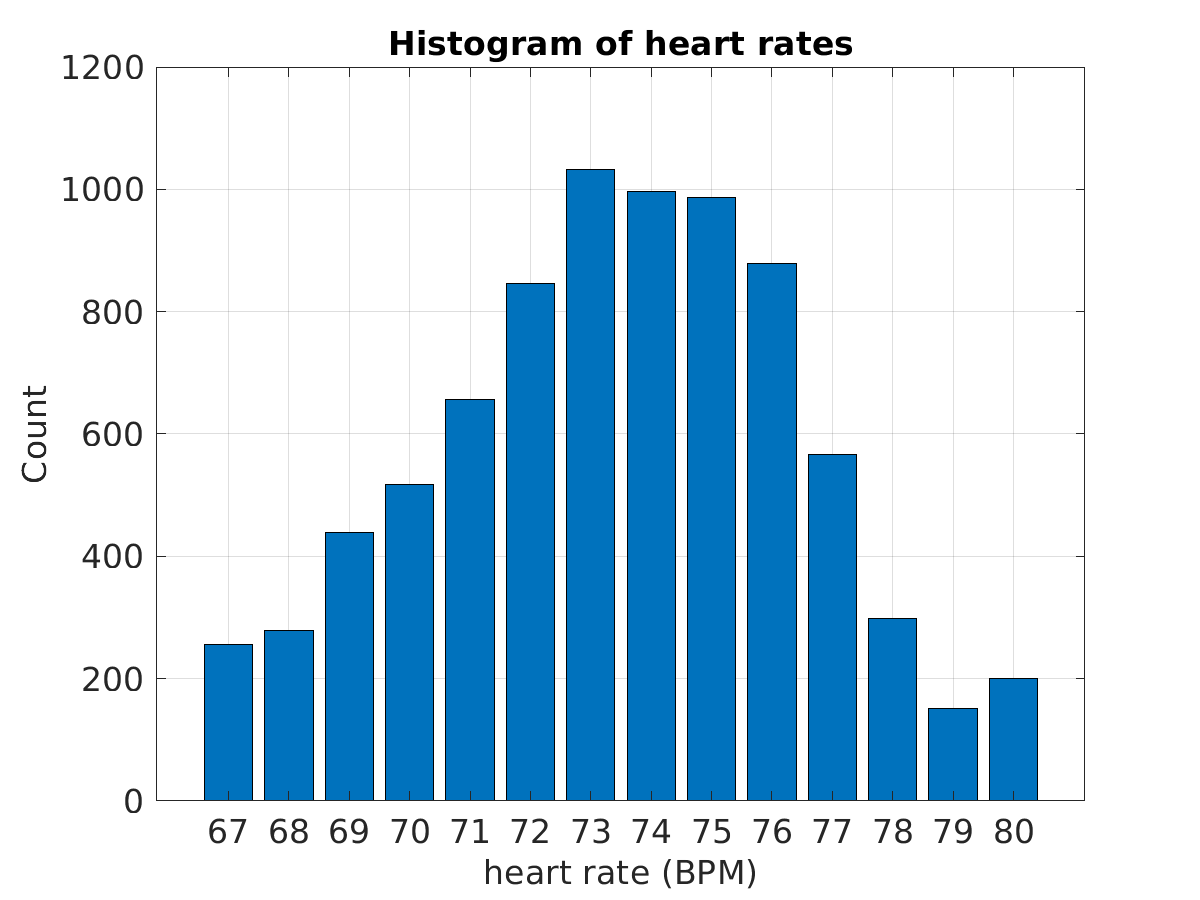 S024_ecg_hr_hist