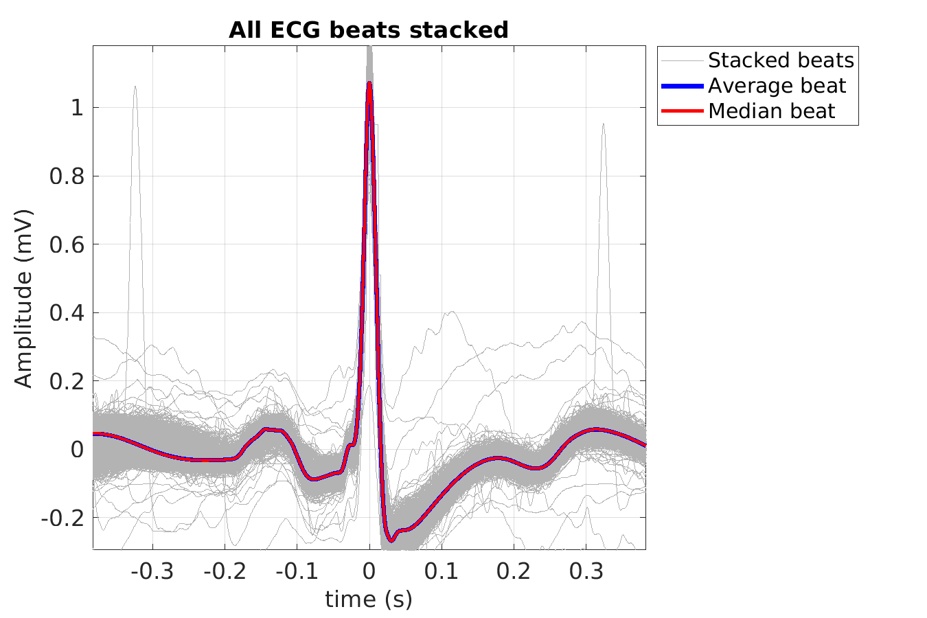 S025_ecg_beats_stacked