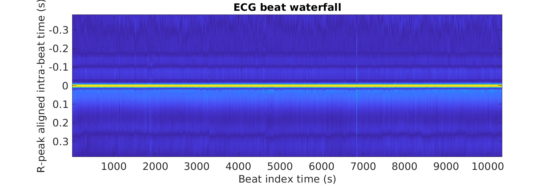 S025_ecg_beats_waterfall