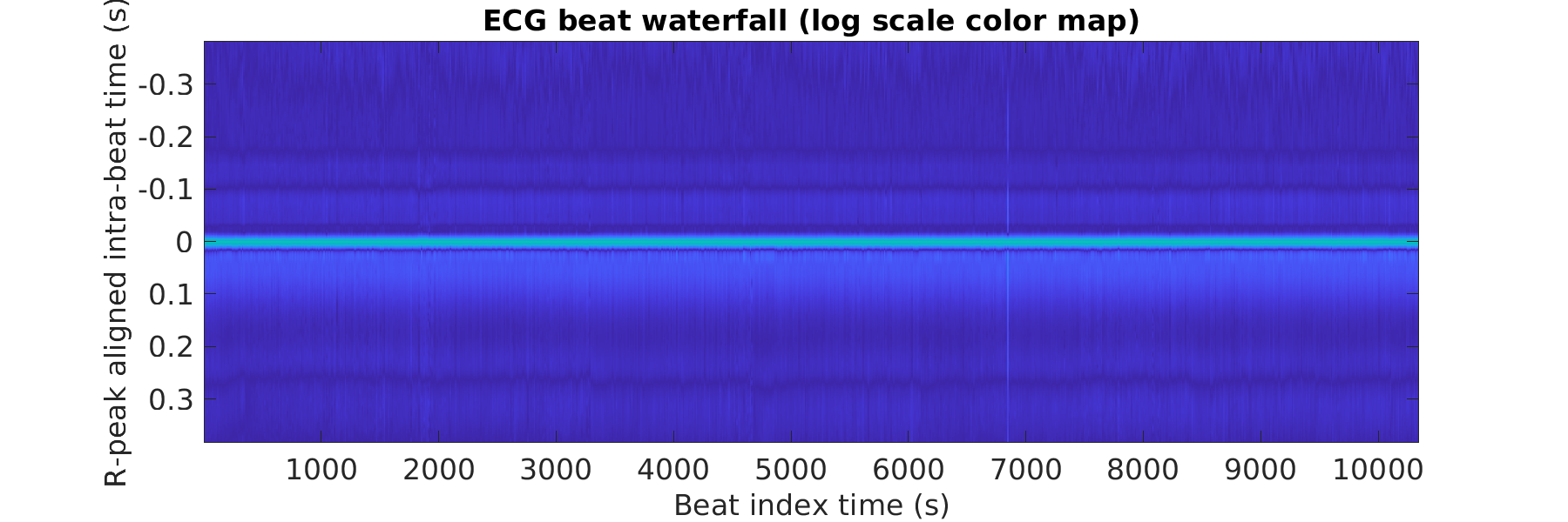 S025_ecg_beats_waterfall_logscale