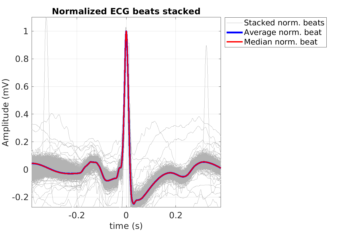 S025_ecg_norm_beats_stacked