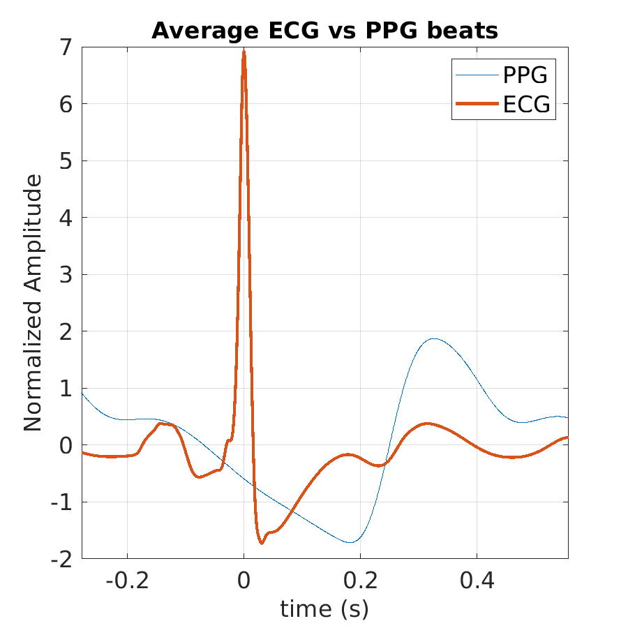 S025_ppg_avg_ecg_ppg