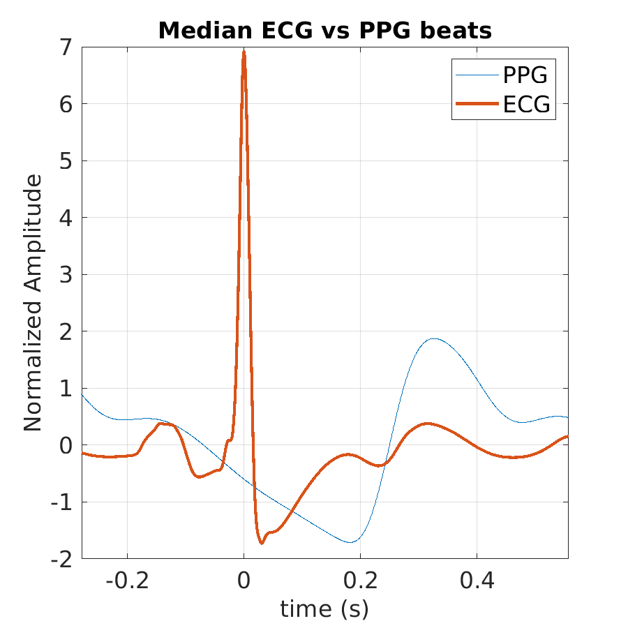 S025_ppg_med_ecg_ppg