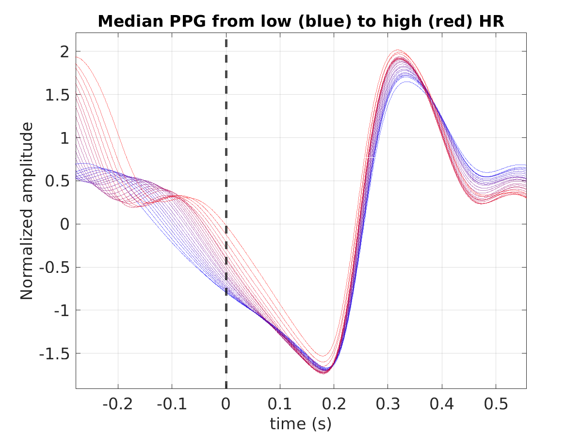 S025_ppg_med_ppg_hr_binned_norm