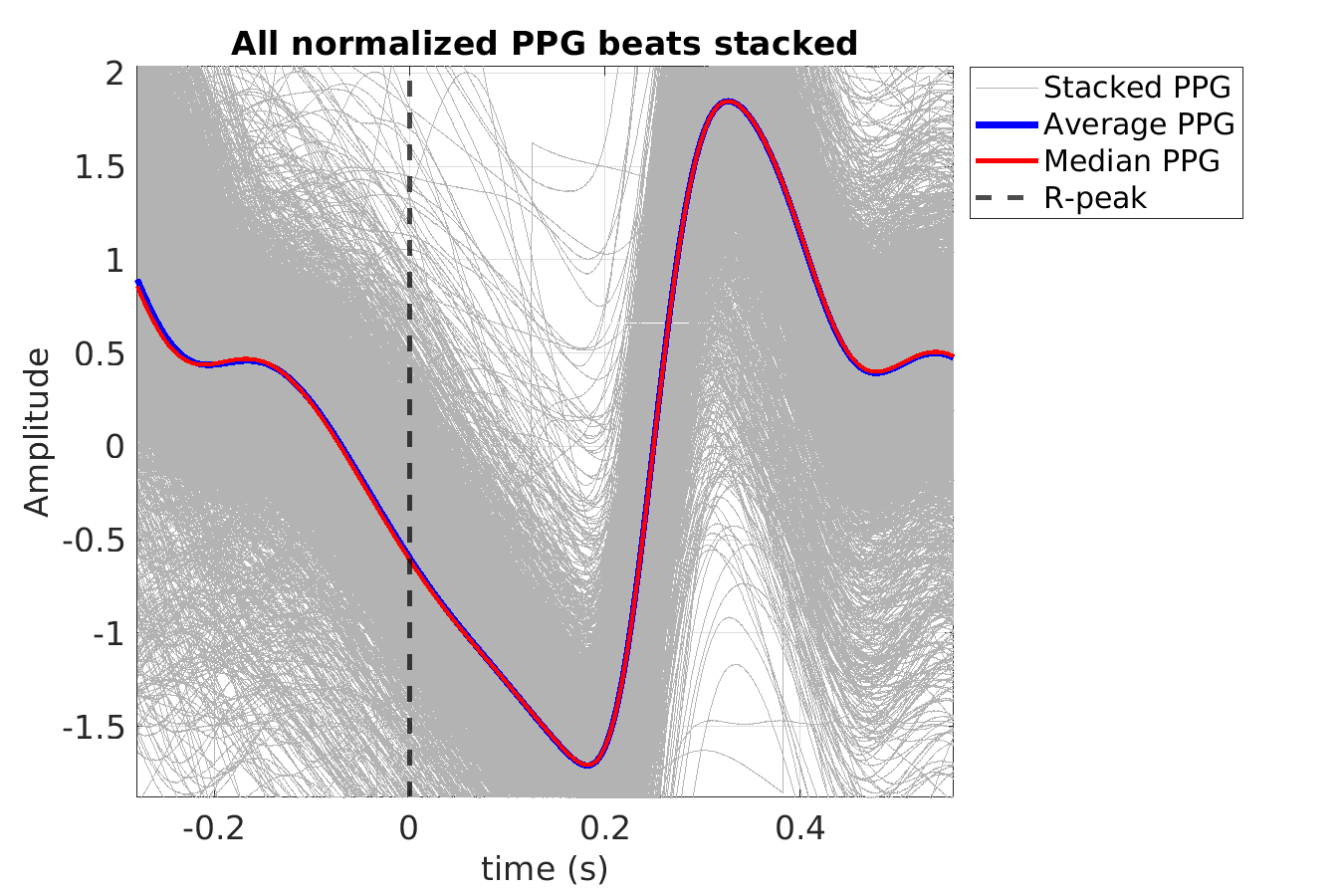 S025_ppg_ppg_stacked_norm