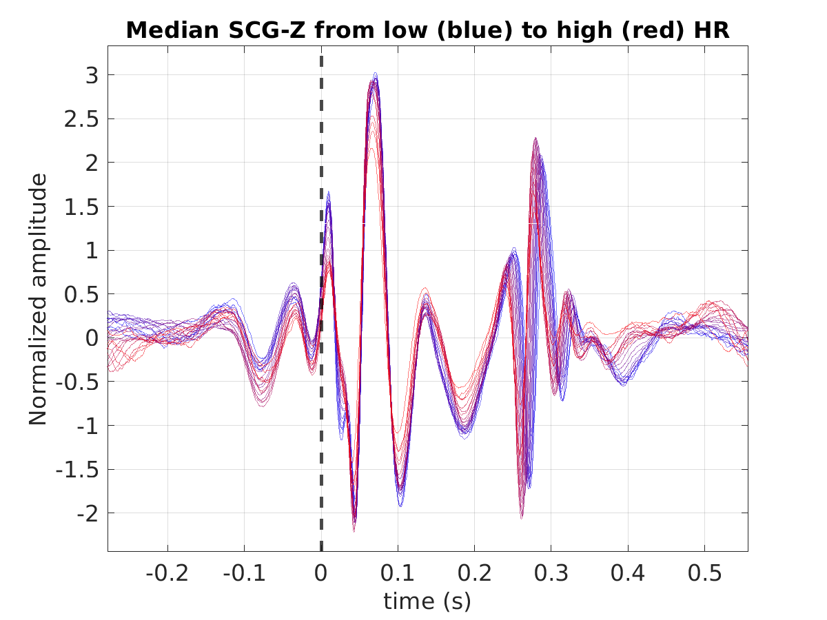 S025_scg_med_scgz_hr_binned_norm