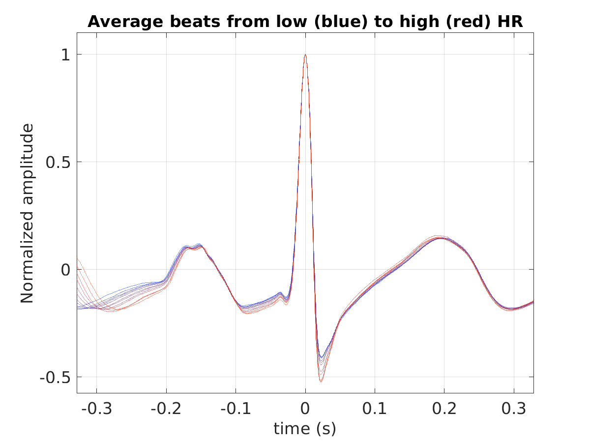 S026_ecg_avg_beats_hr_binned