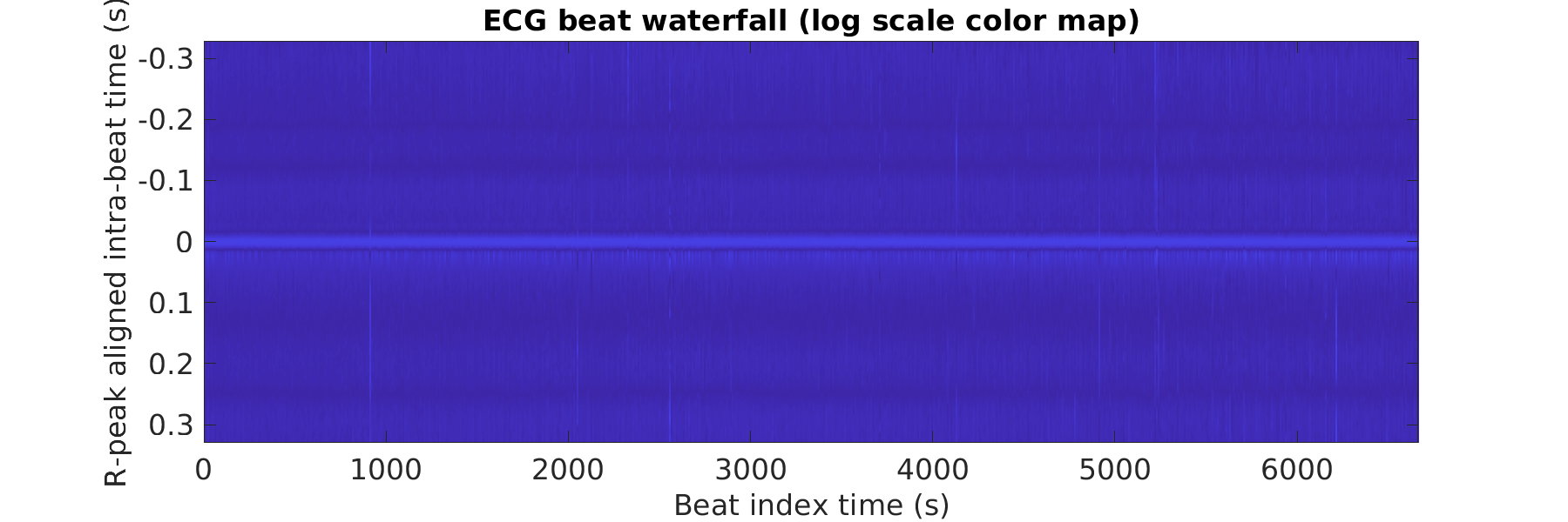 S026_ecg_beats_waterfall_logscale