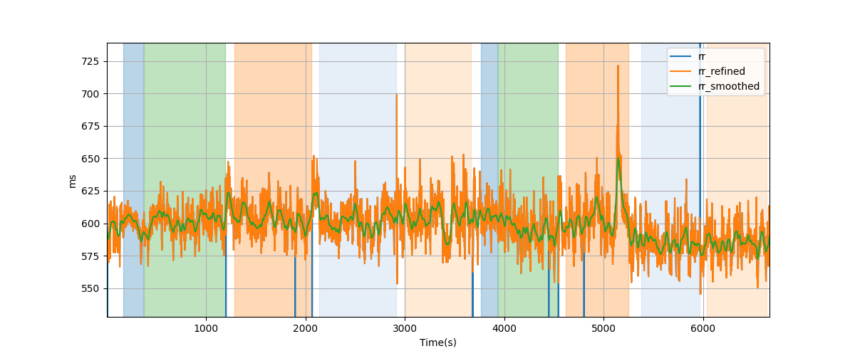 RR intervals - Overlay