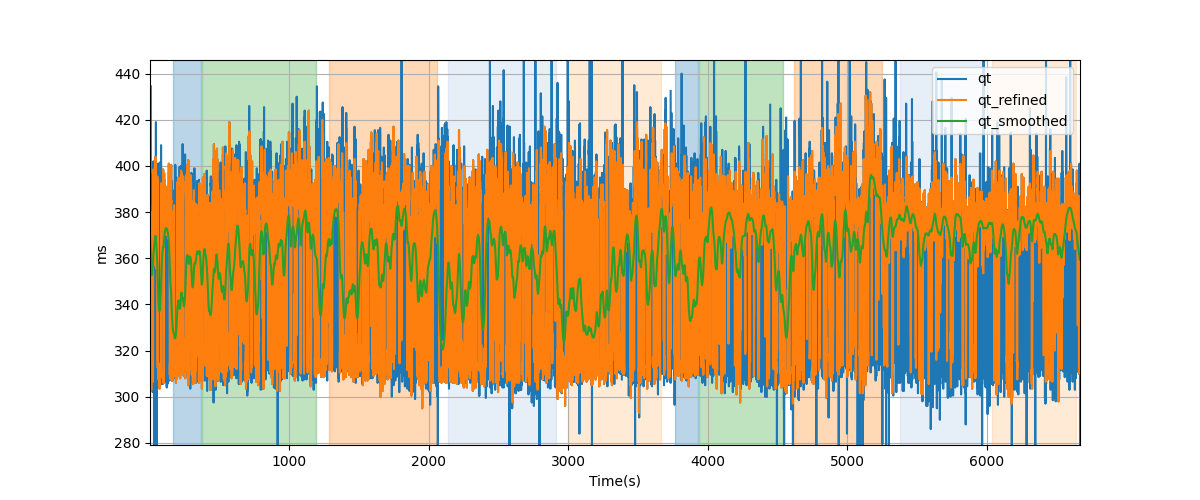 QT intervals - Overlay