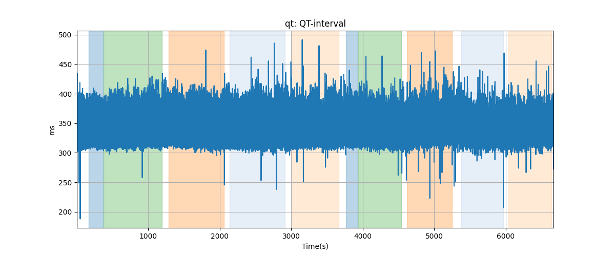 qt: QT-interval